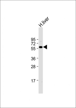 ALDH6A1 Antibody (N-term)