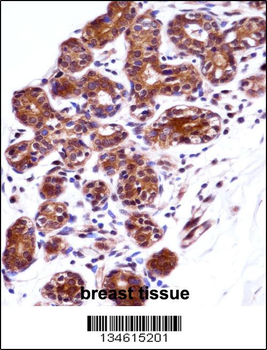 IMPDH1 Antibody (N-term)