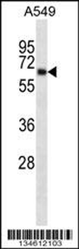 KCNA3 Antibody (Center)
