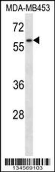 FANCG Antibody (C-term)