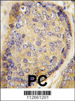 Latexin Antibody (Center)