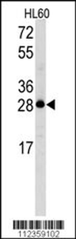 Latexin Antibody (N-term)