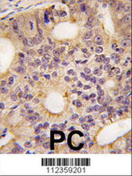 Latexin Antibody (N-term)