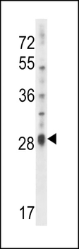 IL17D Antibody (C-term)