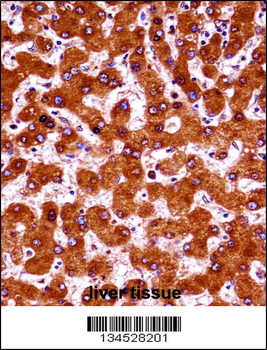 UBE4A Antibody (Center)