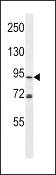 PLD2 Antibody (N-term)