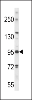 PLD2 Antibody (N-term)