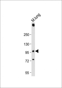 PLD2 Antibody (N-term)