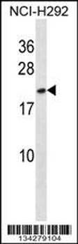HMGB3 Antibody (Center)
