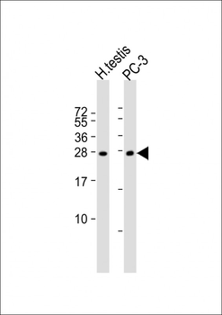 IL25 Antibody (Center)