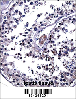 IL25 Antibody (Center)