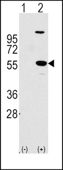 ALDH1A1 Antibody (Center)