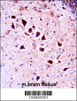 Mouse Ntrk3 Antibody (N-term)