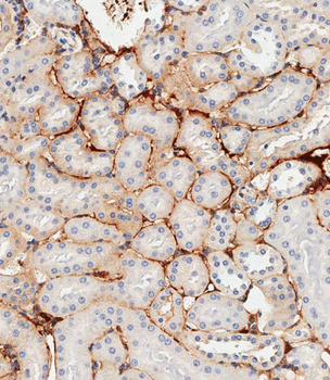Mouse Ddr2 Antibody (C-term)