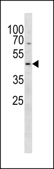 PSMC2 Antibody (N-term)