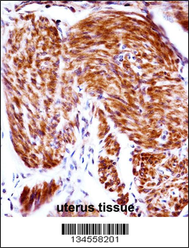 PAEP Antibody (Center)