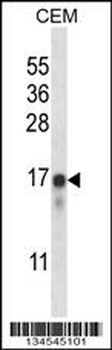 FREQ Antibody (N-term)