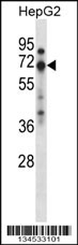 ZNF395 Antibody (Center)
