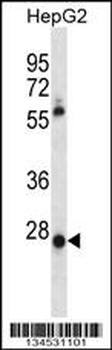 MEOX1 Antibody (Center)