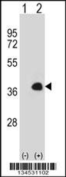 MEOX1 Antibody (Center)