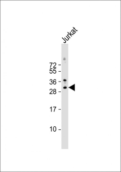 MEOX1 Antibody (Center)