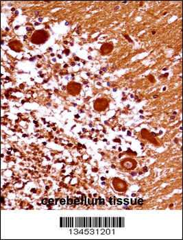 MEOX1 Antibody (Center)