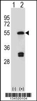 FDFT1 Antibody (C-term)