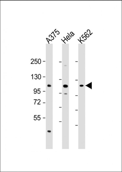 IDE Antibody (Center)