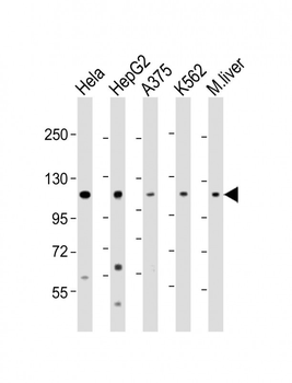 IDE Antibody (Center)