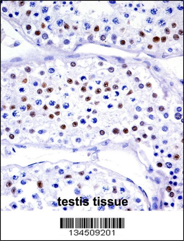 UBA1 Antibody (N-term)