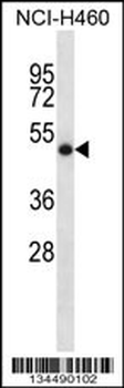 SOCS4 Antibody (Center)