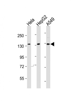 AATK Antibody (N-term)