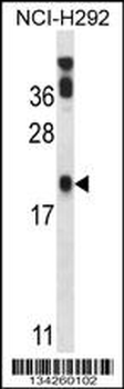 PERP Antibody (C-term)