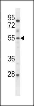 ETV6 Antibody (Center)