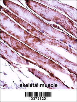 MYL3 Antibody (N-term)