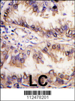 SPAK (STK39) Antibody (C-term)