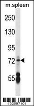 CNGA2 Antibody (N-term)