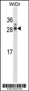 Rat Hoxa7 Antibody (N-term)