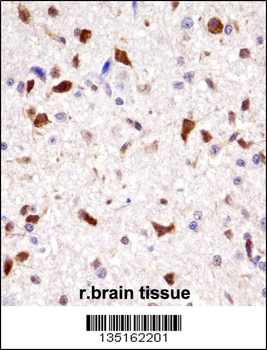 Rat Hoxa7 Antibody (N-term)
