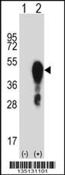 Mouse Hoxa1 Antibody (Center)