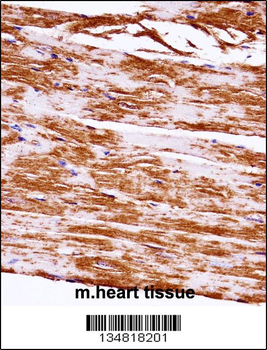 Mouse Map3k5 Antibody (C-term)