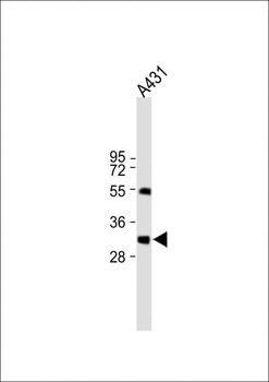 Stanniocalcin-2 (STC2) Antibody (N-term)
