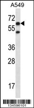 CHFR Antibody (C-term)