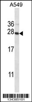 POLR2E Antibody (N-term)