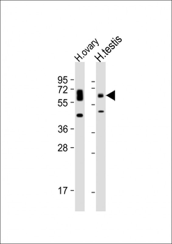 POTE Antibody (C-term L446)
