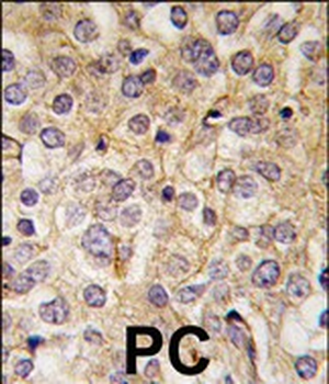 POTE Antibody (C-term L446)