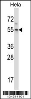 HM13 Antibody (C-term)