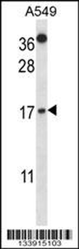 CSTA Antibody (C-term)