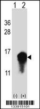 CSTA Antibody (C-term)