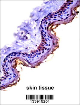 CSTA Antibody (C-term)